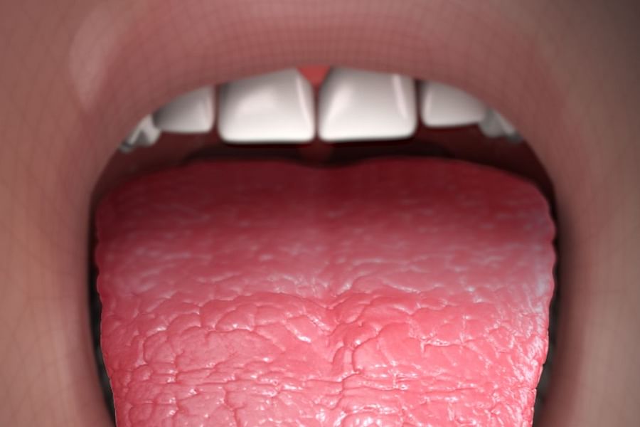 dry mouth symptom