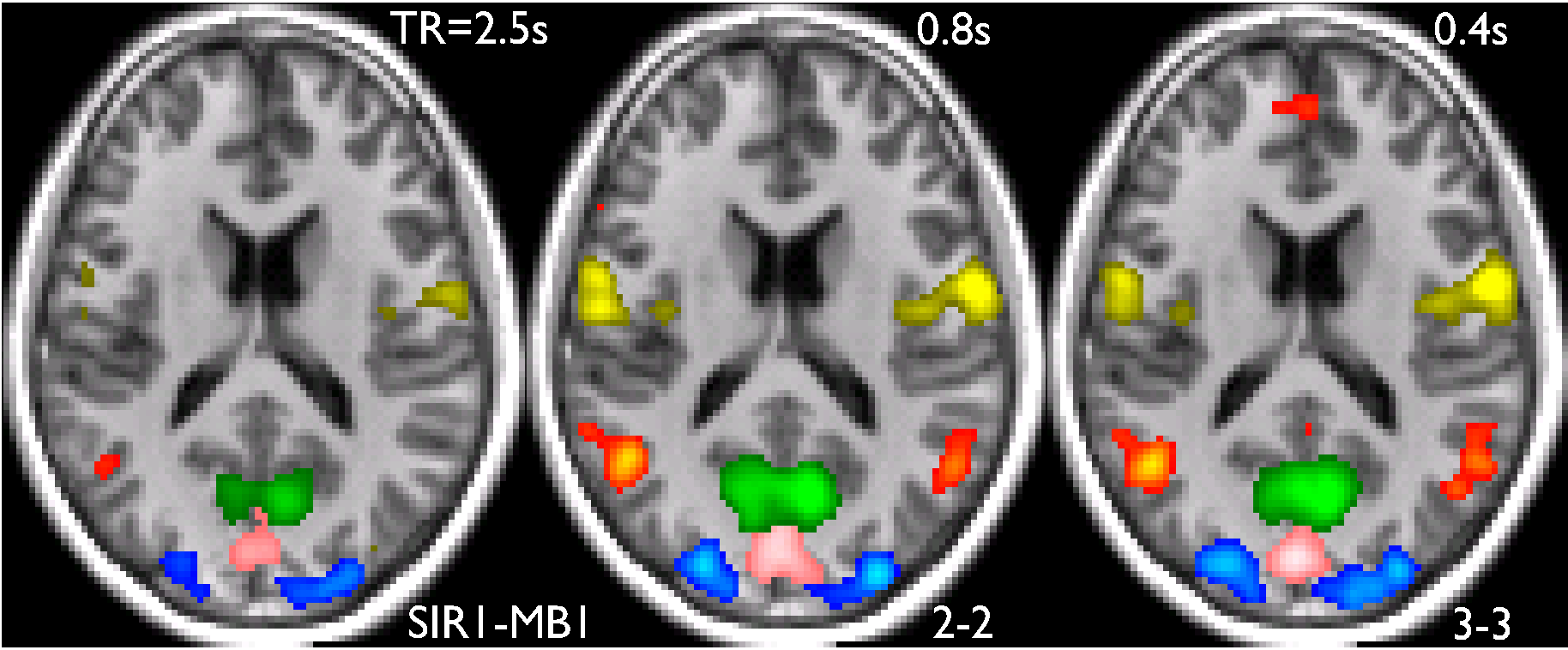 default mode network