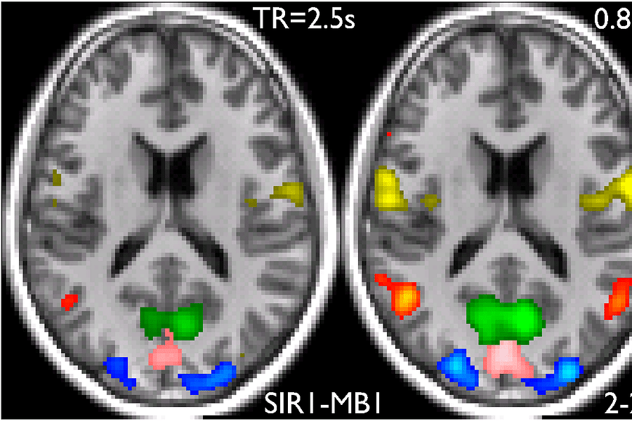 default mode network
