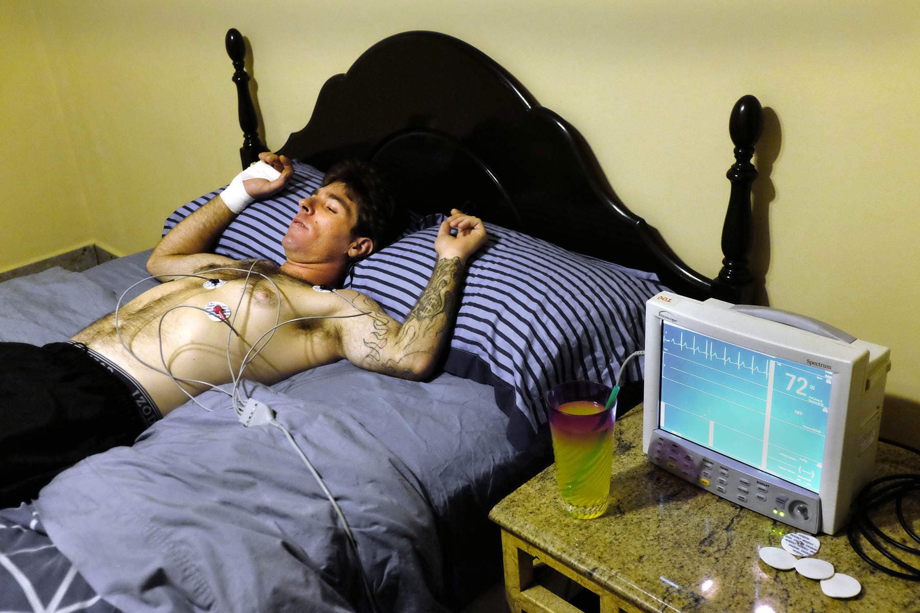 ibogaine therapy experience